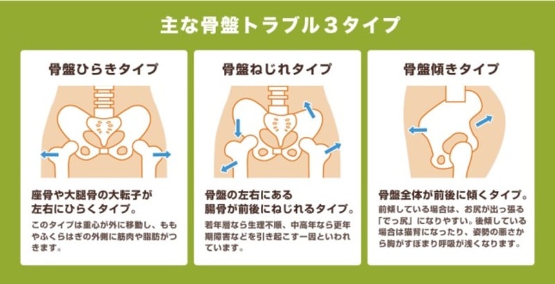 骨盤矯正 いずみ整骨院